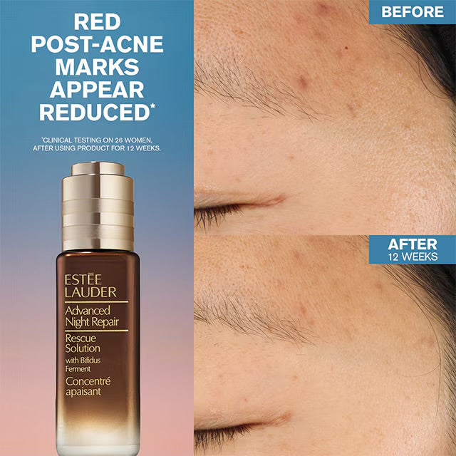 Estee Lauder Advanced Night Repair
Rescue Solution Serum with 15% Bifidus Ferment