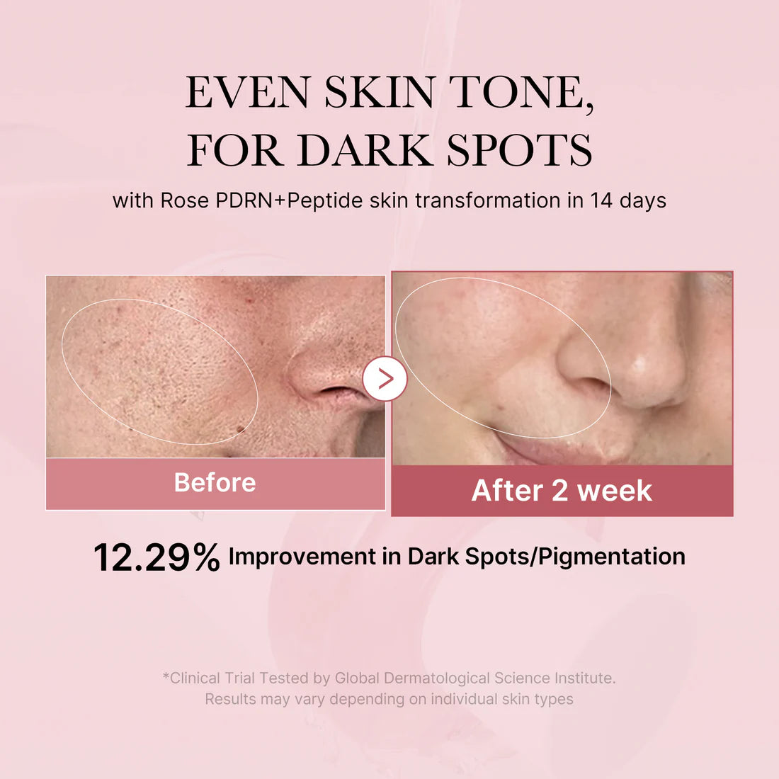 Medicube PDRN Pink Niacinamide Milky Toner